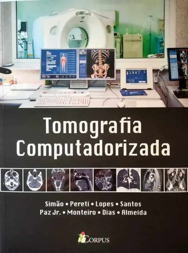 TOMOGRAFIA COMPUTADORIZADA